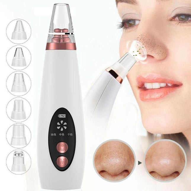 Peekaboo Studio Blackhead Pore Vacuum - Deep Cleansing & Acne Removal