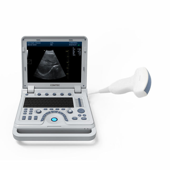 CMS1700B Portable Color Doppler Ultrasound Scanner Cardiology System With Probe