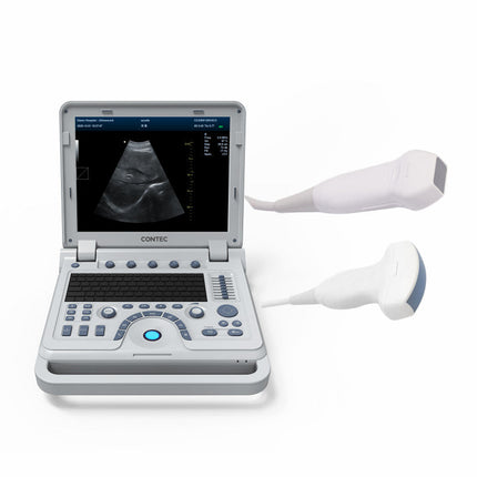 CMS1700B Portable Color Doppler Ultrasound Scanner Cardiology System With Probe