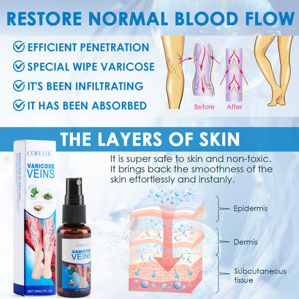 VeinCare 30ml Varicose Vein Spray - Promotes Blood Circulation & Comfo