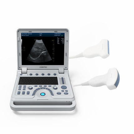CMS1700B Portable Color Doppler Ultrasound Scanner Cardiology System With Probe