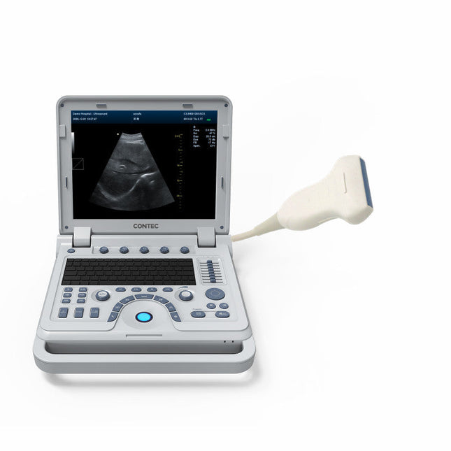 CMS1700B Portable Color Doppler Ultrasound Scanner Cardiology System With Probe