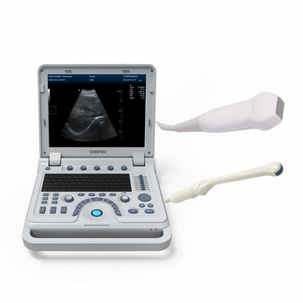 CMS1700B Portable Color Doppler Ultrasound Scanner Cardiology System With Probe