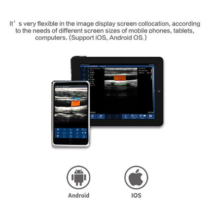 CMS1600B-VET Handheld Dual-Probe Color Doppler Veterinary Ultrasound WiFi