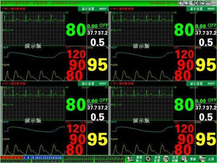 CONTEC Central Monitoring System Networked to CONTEC Patient Monitors