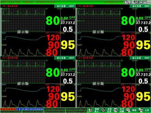 CONTEC Central Monitoring System Networked to CONTEC Patient Monitors