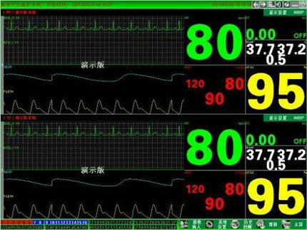 CONTEC Central Monitoring System Networked to CONTEC Patient Monitors