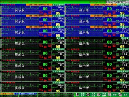 CONTEC Central Monitoring System Networked to CONTEC Patient Monitors