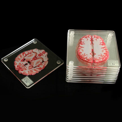 Neuroscience-Inspired Brain Specimen Coaster Set for Intellectual Decor