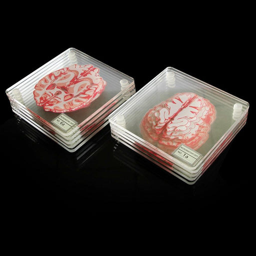 Brain Specimen Coasters Set 3D Organ Brain Artwork Brain Slices Square Acrylic Glass Drinks Table Coaster Drunk Scientists Gift-0-Très Elite-Très Elite