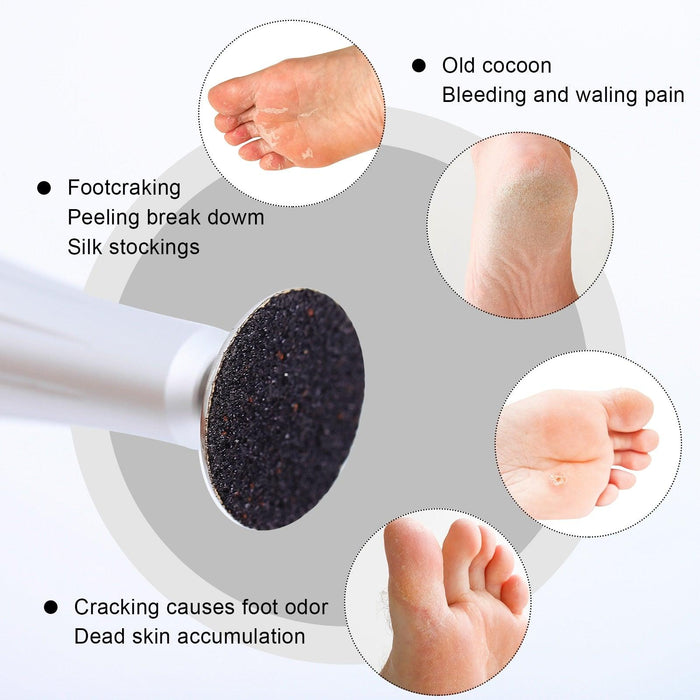 Luxury Foot Care Kit with Variable Grit Settings and Replaceable Tips