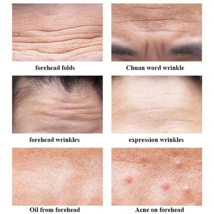 Youthful Glow Forehead Wrinkle Eraser Patch