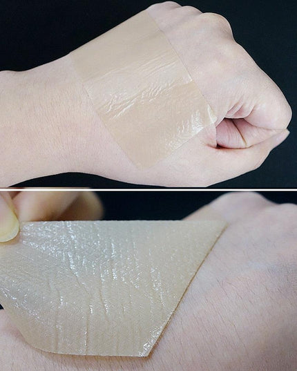 Ultimate Silicone Scar Healing Patch - Revolutionary Treatment for Scars