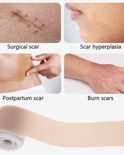 Ultimate Silicone Scar Healing Patch - Revolutionary Treatment for Scars