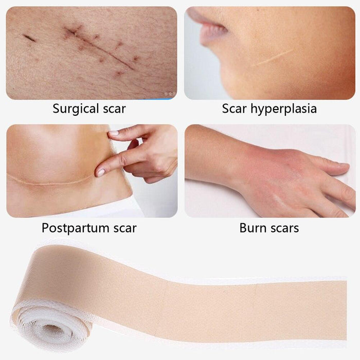 Silicone Scar Eradication Gel Tape - Revolutionary Skin Rejuvenation