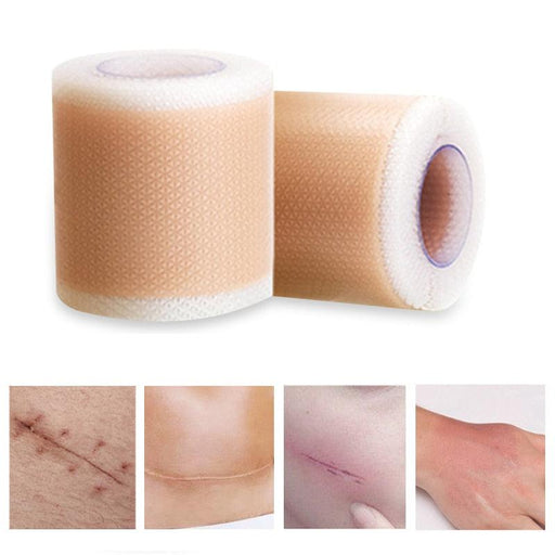 Silicone Scar Removal Gel Tape - Innovative Skin Renewal Technology