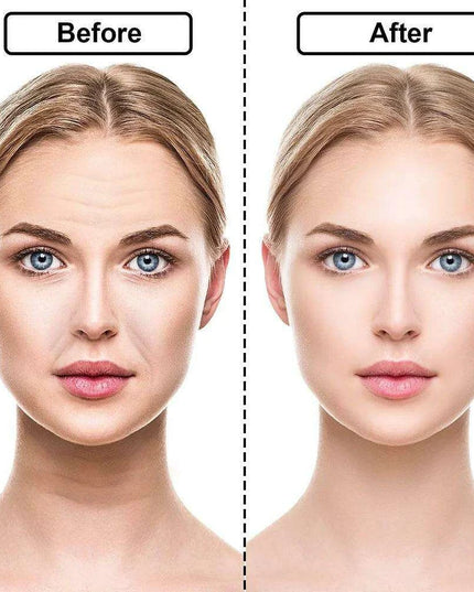 Silicone Anti-Wrinkle Patch Set for Ultimate Youthful Skin Revitalization