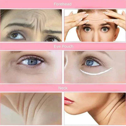 Silicone Anti-Wrinkle Facial Patches - Complete Rejuvenation System - Très Elite