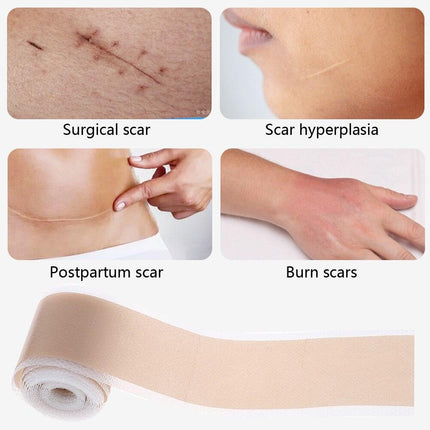 Ultimate Silicone Scar Healing Patch - Revolutionary Treatment for Scars - Très Elite