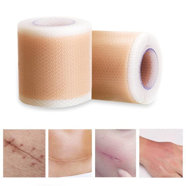 Ultimate Silicone Scar Healing Patch - Revolutionary Treatment for Scars
